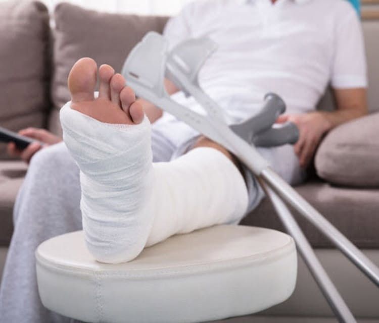 Jak wrócić do formy po złamaniu: skuteczna rehabilitacja